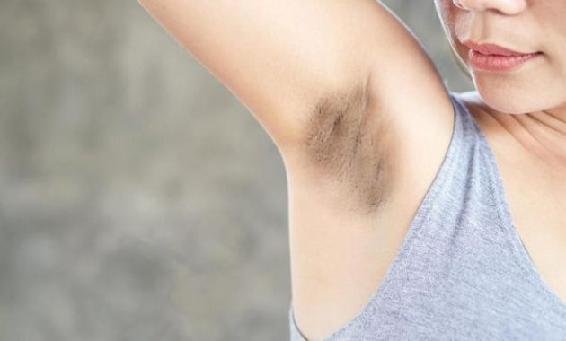 cara membersikan ketiak yang hitam menjadi putih